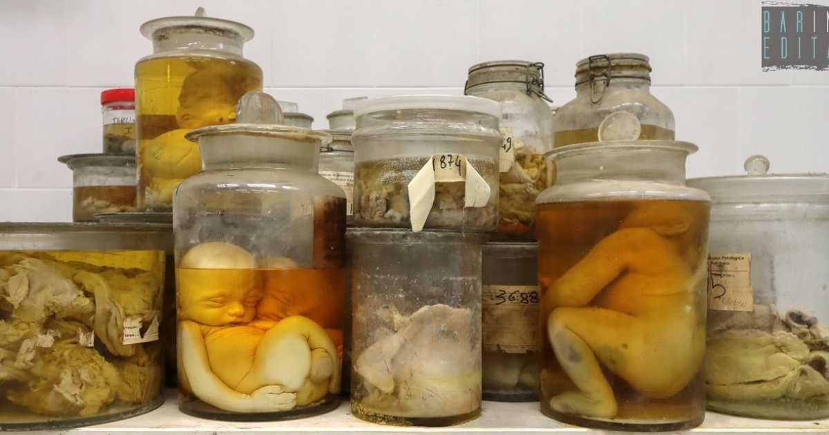 Organi malati e feti malformati: nel Policlinico potrebbe nascere il "museo del materiale anatomico"